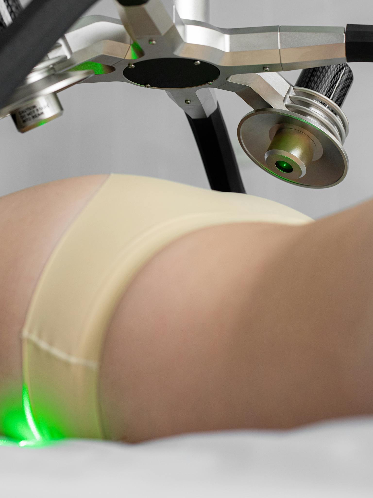 Crop anonymous female client lying on laser liposuction therapy in modern clinic in daytime