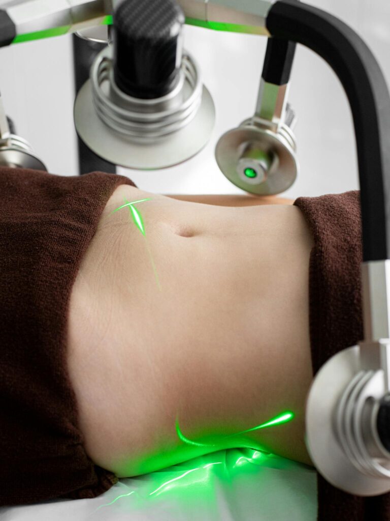 Crop anonymous female patient lying under green lasers of modern weight loss machine with heads during treatment in medical clinic