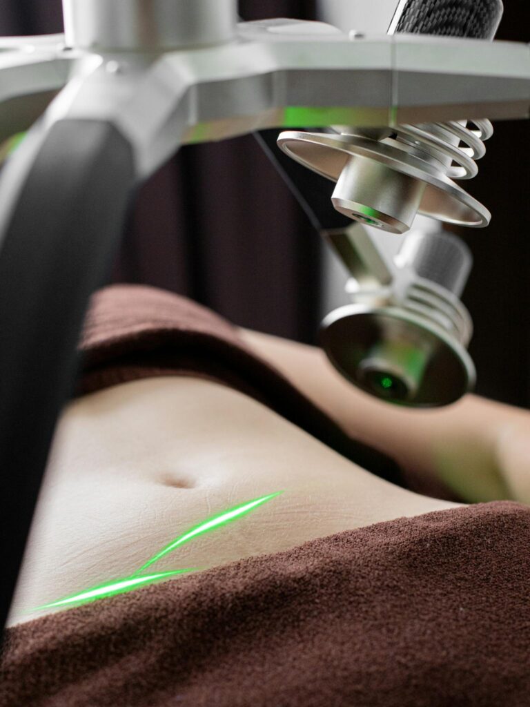 Crop unrecognizable female client covered with towels lying under laser weight loss machine with heads during procedure in light modern clinic