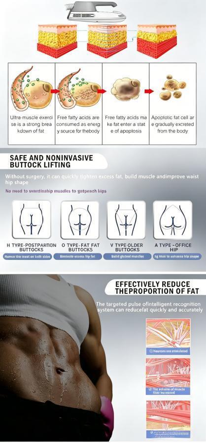 EMSnova fat reduction treatment for buttock lifting. Safe non-invasive, no surgery, no exercise needed