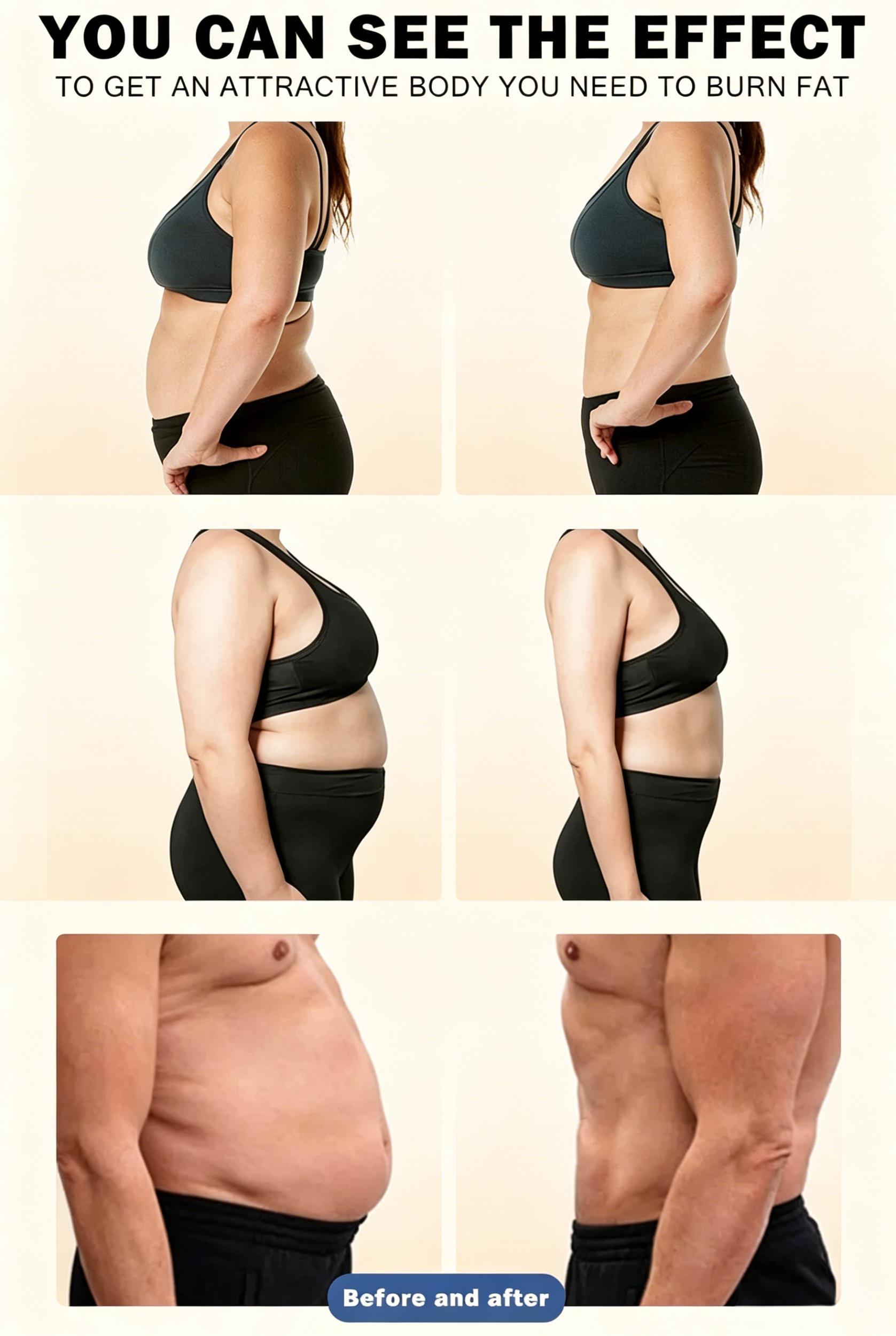 EMSnova before and after fat burning results for attractive body transformation