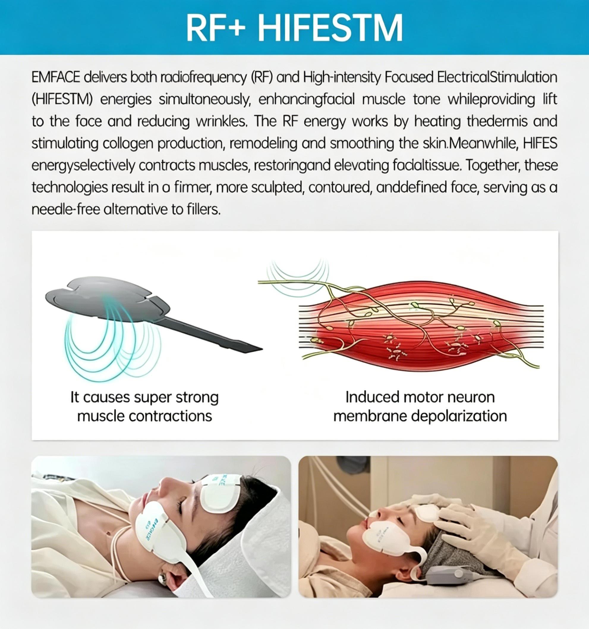 EMSnova RF HIFES facial treatment: stimulates collagen, contracts muscles for face lifting, needle-free alternative to fillers